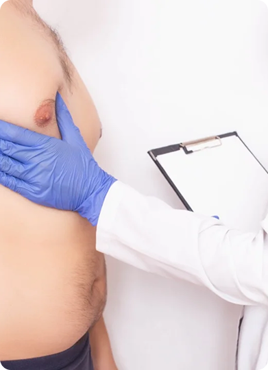 Gynecomastia Treatment in Tiruvannamalai