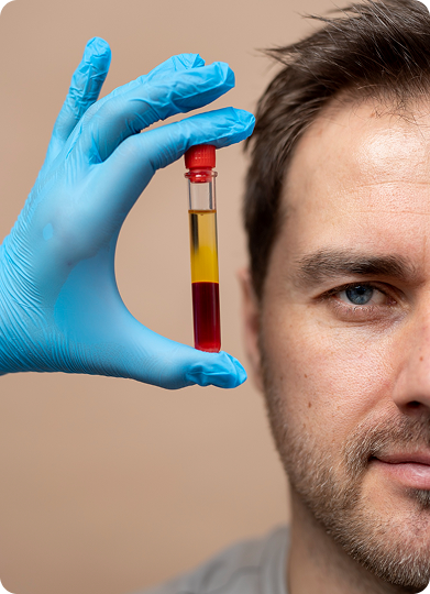 PRP for Hair Growth in Tiruvannamalai, Tamil Nadu