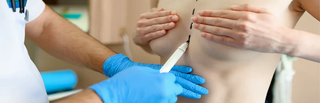 Transgender Breast Implants in Tamil Nadu