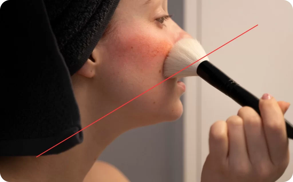 After a Botox injection, strenuous exercise and heat exposure should be avoided for a day. Gentle care helps maintain smooth results and balanced muscle relaxation.