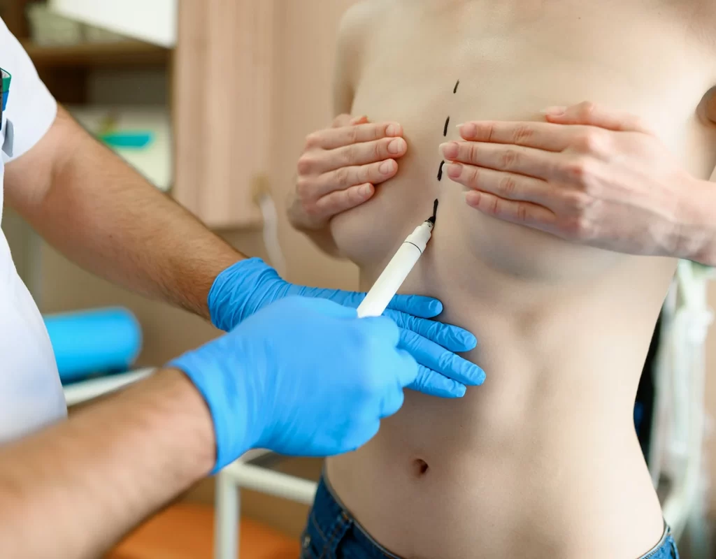 Transgender Breast Implants in Tamil Nadu