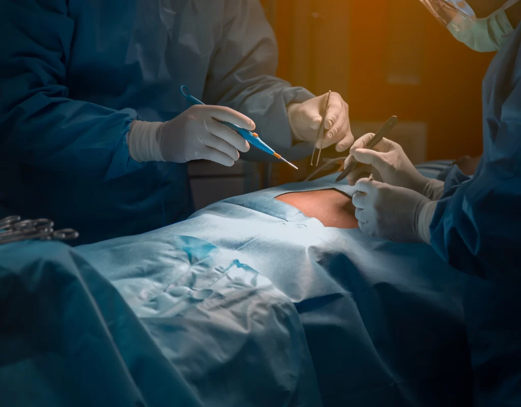 Transgender Breast Implants in Tamil Nadu