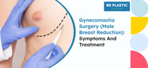 Gynecomastia Surgery (Male Breast Reduction): Symptoms and Treatment