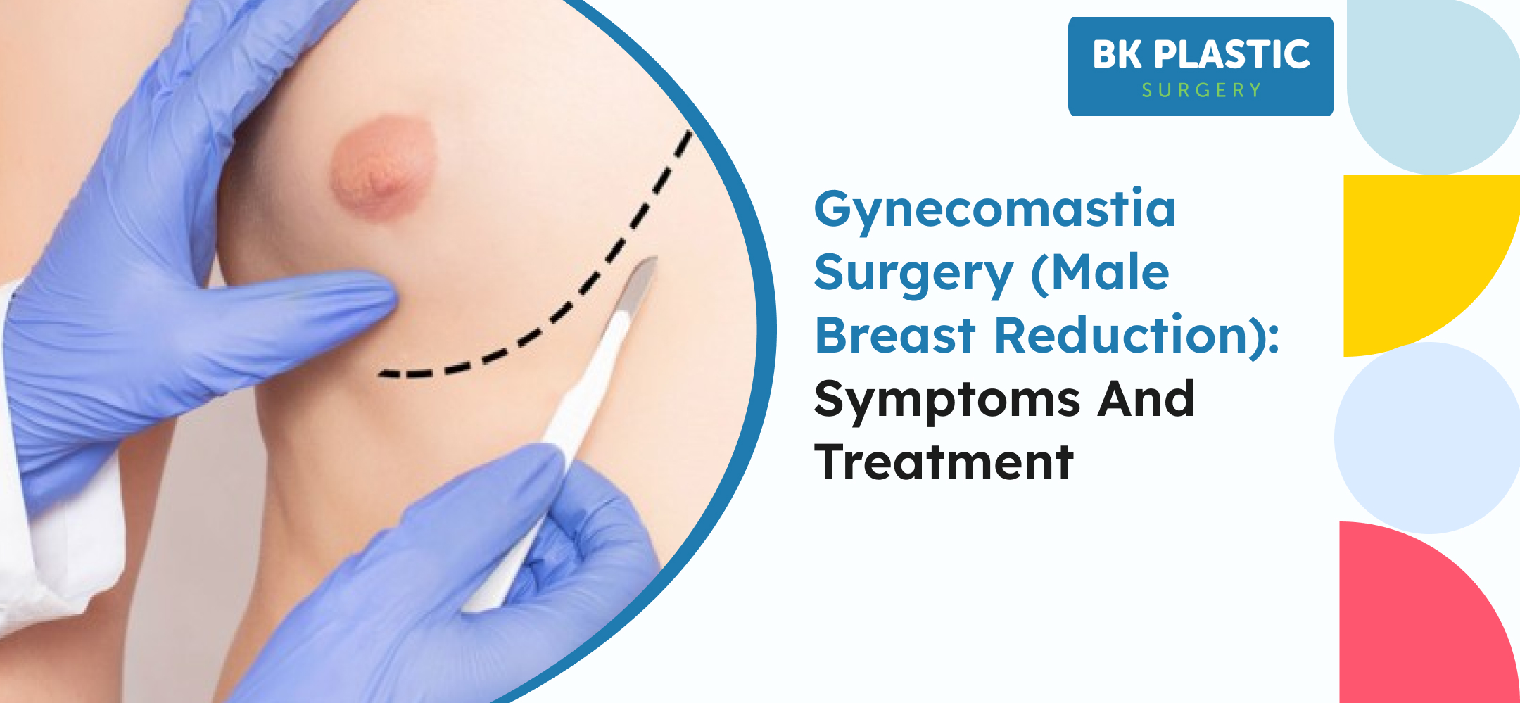 Gynecomastia Surgery (Male Breast Reduction): Symptoms and Treatment