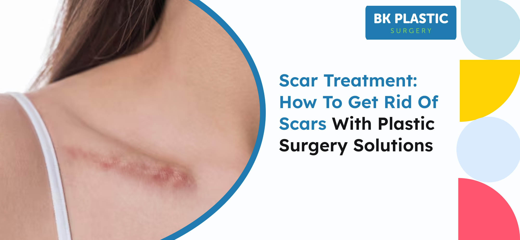 Scar Treatment: How to Get Rid of Scars